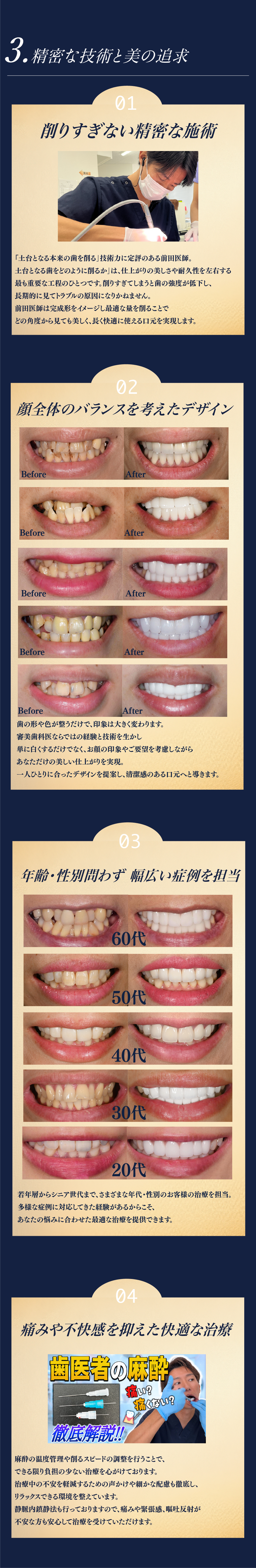 選ばれる理由3　精密な技術と美の追求
