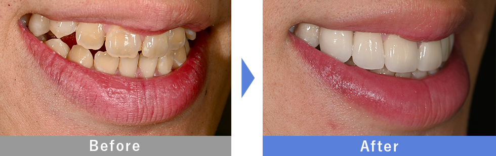 伊藤健医師症例1