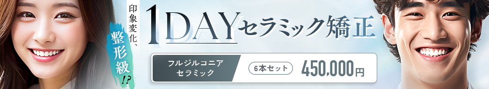 1dayセラミック