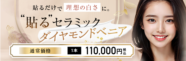 ダイヤモンドベニア