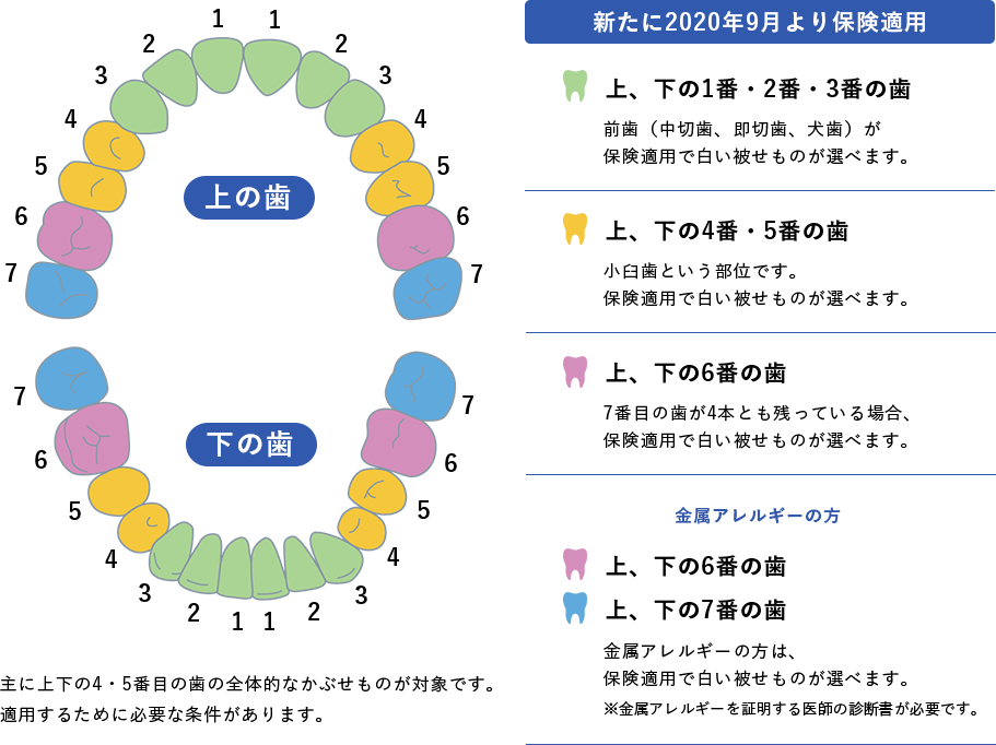 CAD/CAM冠の保険適用部位について