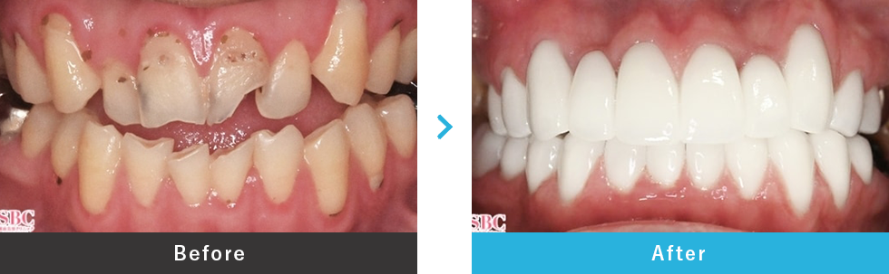 ダイヤモンドオーダーセラミック