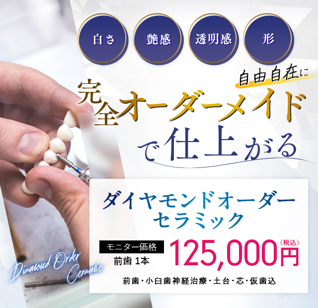 完全オーダーメイドで仕上がる ダイヤモンドオーダーセラミック モニター価格前歯1本 114,500円（税込）