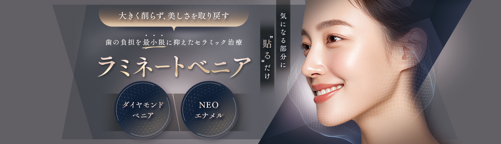 ラミネートべニア