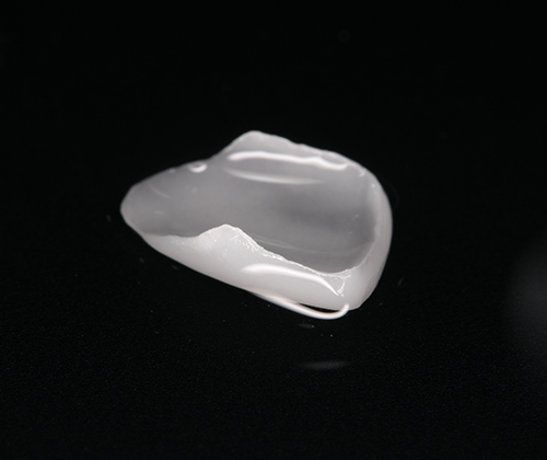 step04 歯の型取りを行い、咬み合わせや形を確認