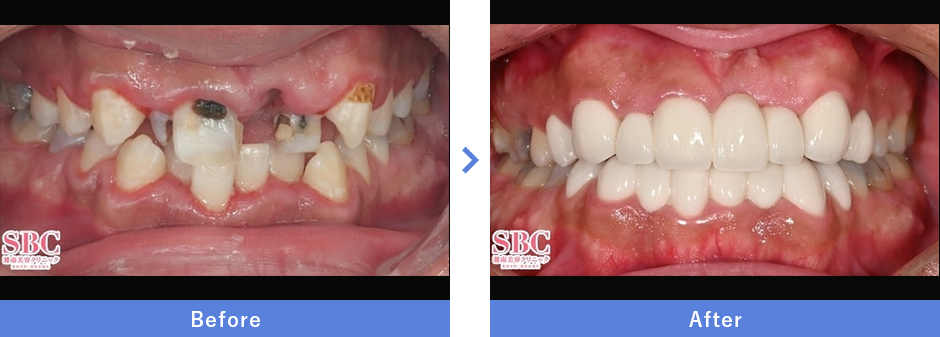 症例写真：大阪・22歳女性