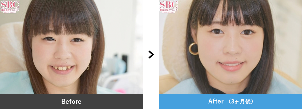 セラミック 症例写真