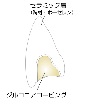 プレミアムダイヤモンドセラミックの特長イメージ