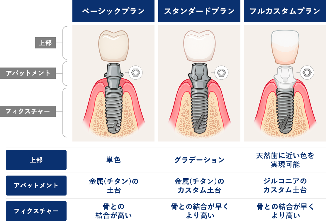 ベーシックプラン スタンダードプラン フルカスタムプラン の違い