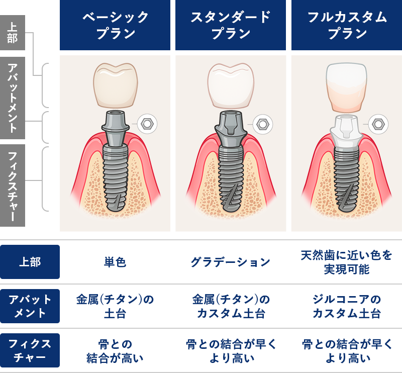 ベーシックプラン スタンダードプラン フルカスタムプラン の違い
