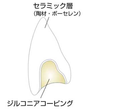 より耐久性の優れたこだわりの歯に！