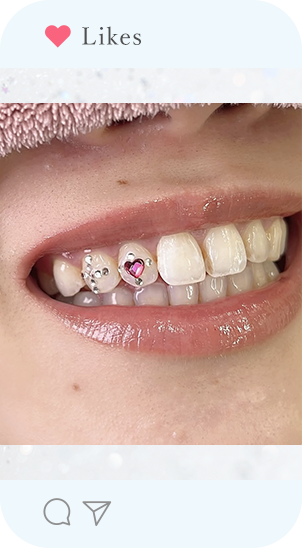 症例写真12