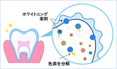 ホワイトニング薬剤イメージ