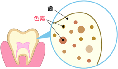 歯の色素