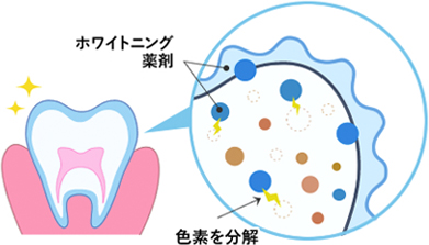 ホワイトニング薬剤イメージ