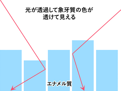 光が透過して象牙質の色が透けて見える