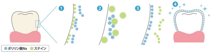 うるつやリッチ～歯のトリートメント～の成分の短鎖分割ポリリン酸Naが、歯の汚れを落とし、コーティングする仕組み